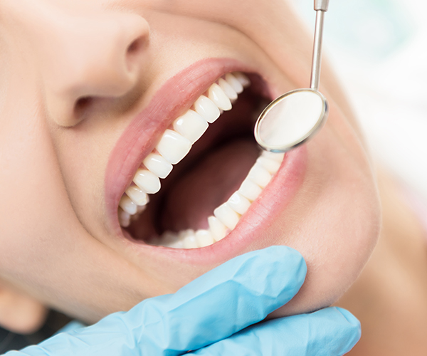 Treating and Prevention for Gum Disease in Tampa Fl image.